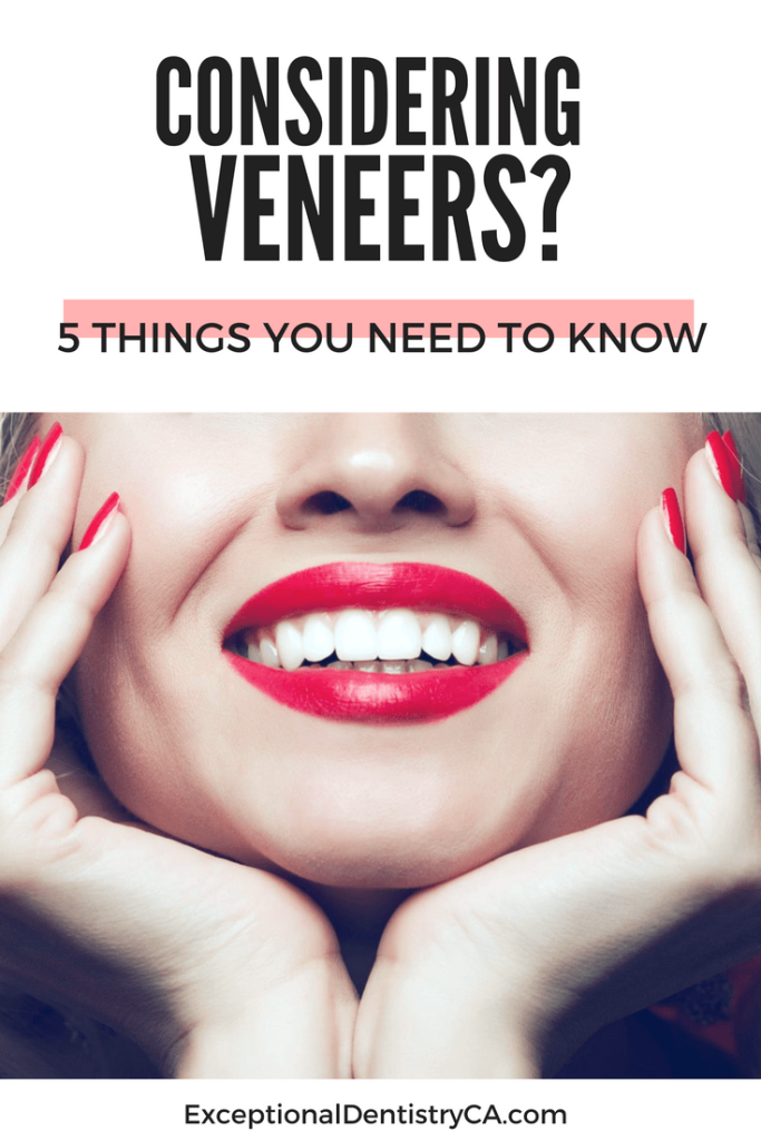 Considering Veneers? 5 Things You Need To Know