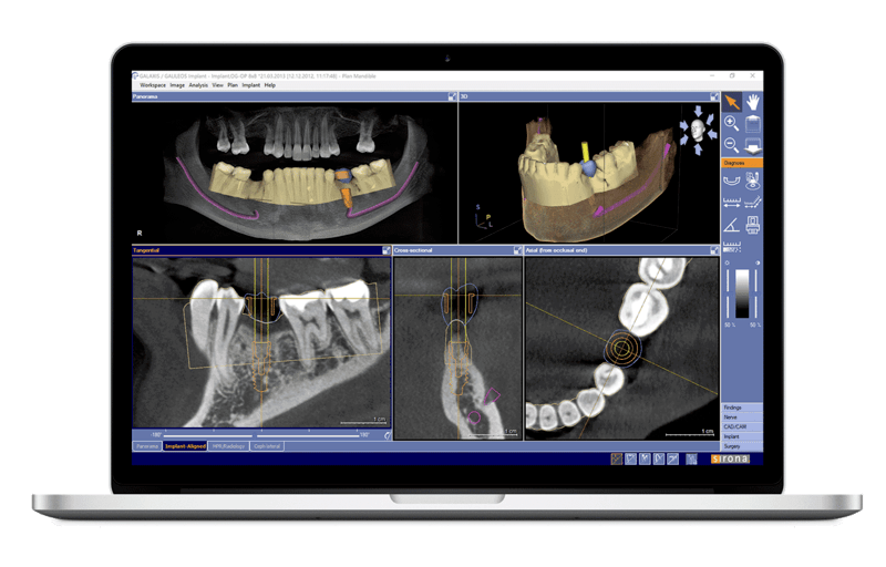 CBCT Exceptional Dentistry Palmdale, CA